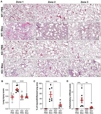 Function of KvLQT1 potassium channels in a mouse model of bleomycin-induced acute lung injury